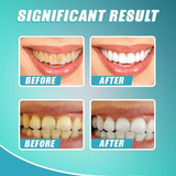 Intensive Stain Removal Whitening Toothpaste