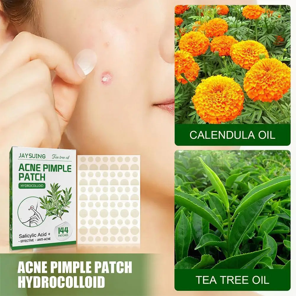 144-Piece Acne Pimple Patches – Salicylic Acid & Tea Tree Oil