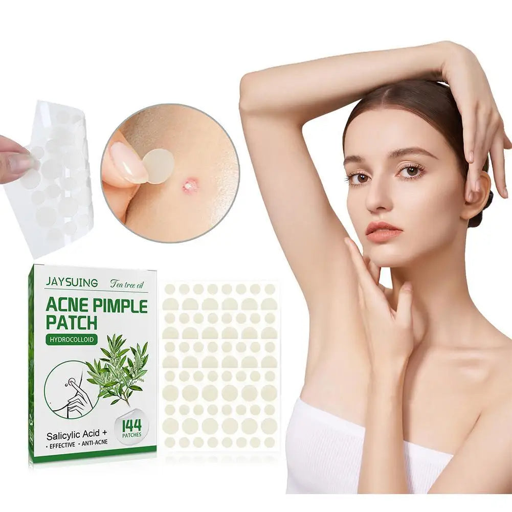 144-Piece Acne Pimple Patches – Salicylic Acid & Tea Tree Oil