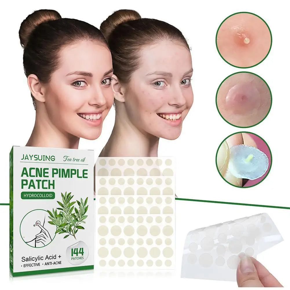 144-Piece Acne Pimple Patches – Salicylic Acid & Tea Tree Oil