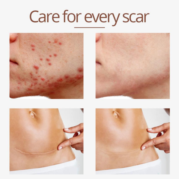 Crocodile Scar Removal Serum