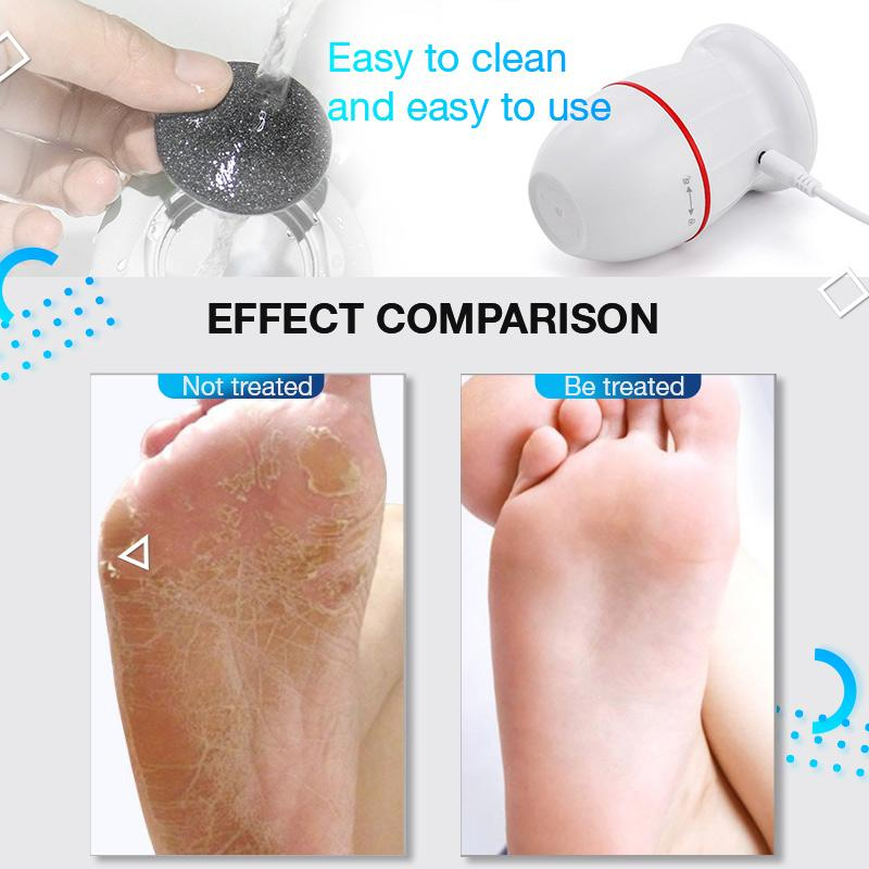 (Deal of the day!!! )USB Rechargeable Vacuum Adsorption Foot Grinder