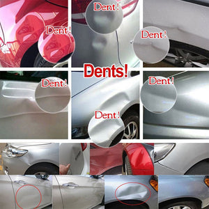 Car Dent Repair Kit - Lifter Suction Cup Tool Set