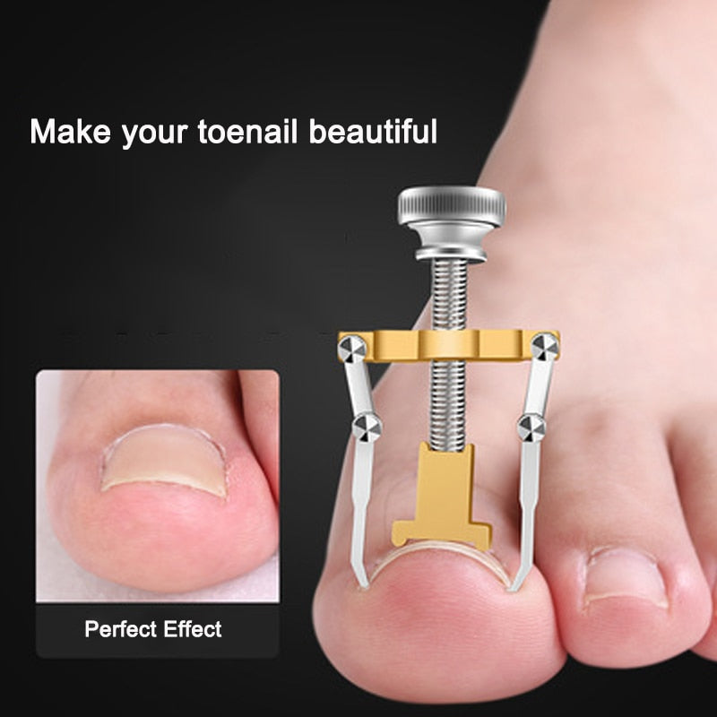 【LM530】Ingrown Toenail Toe Recover Tool